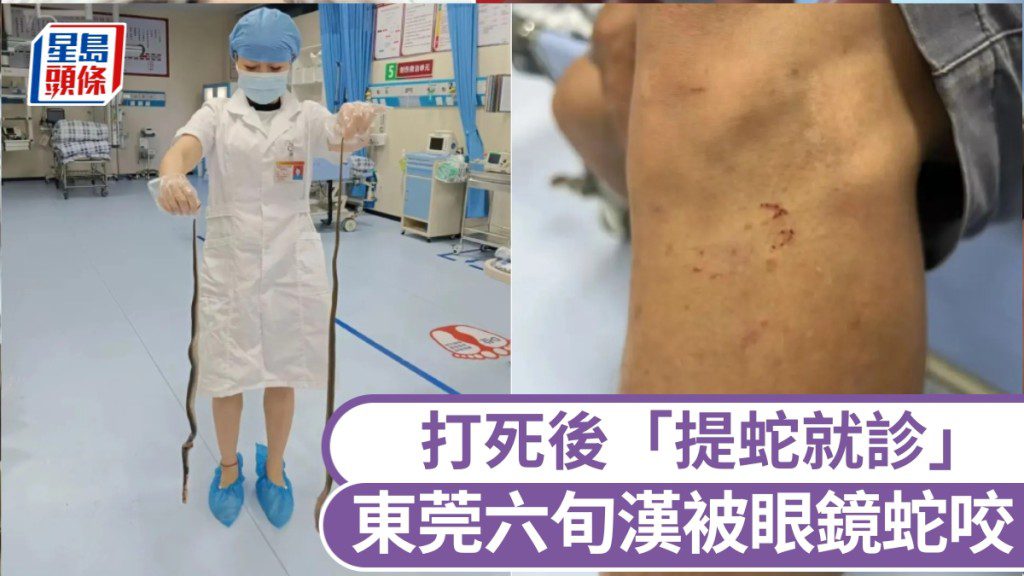 驚險!東莞六旬翁捕魚遭眼鏡蛇咬,怒打死蛇後淡定求醫