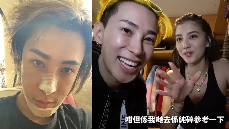 馬天佑坦認整容!公開入行前樣子撞樣TVB男星 曾修整面上兩部位