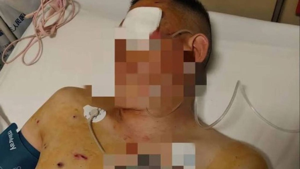 震驚!鄭州男子銀行門前遭搶劫打盲,銀行竟袖手旁觀? 震驚!鄭州男子銀行門前遭搶劫打盲,銀行竟袖手旁觀?