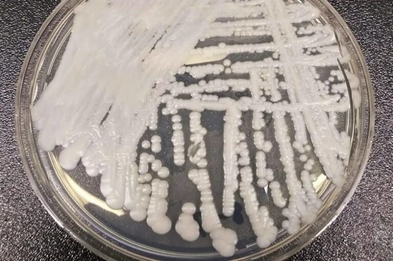 致命超級真菌失控蔓延 全美27州淪陷