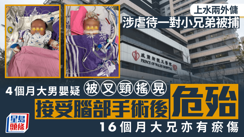 上水虐嬰案｜4個月大男嬰遭叉頸搖晃腦出血命危 警拘兩外傭 兄長同現瘀傷