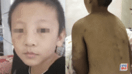 河南14歲少年慘遭生父繼母虐待致死 離世時穿紙尿褲肝肺受損 河南14歲少年慘遭生父繼母虐待致死 離世時穿紙尿褲肝肺受損