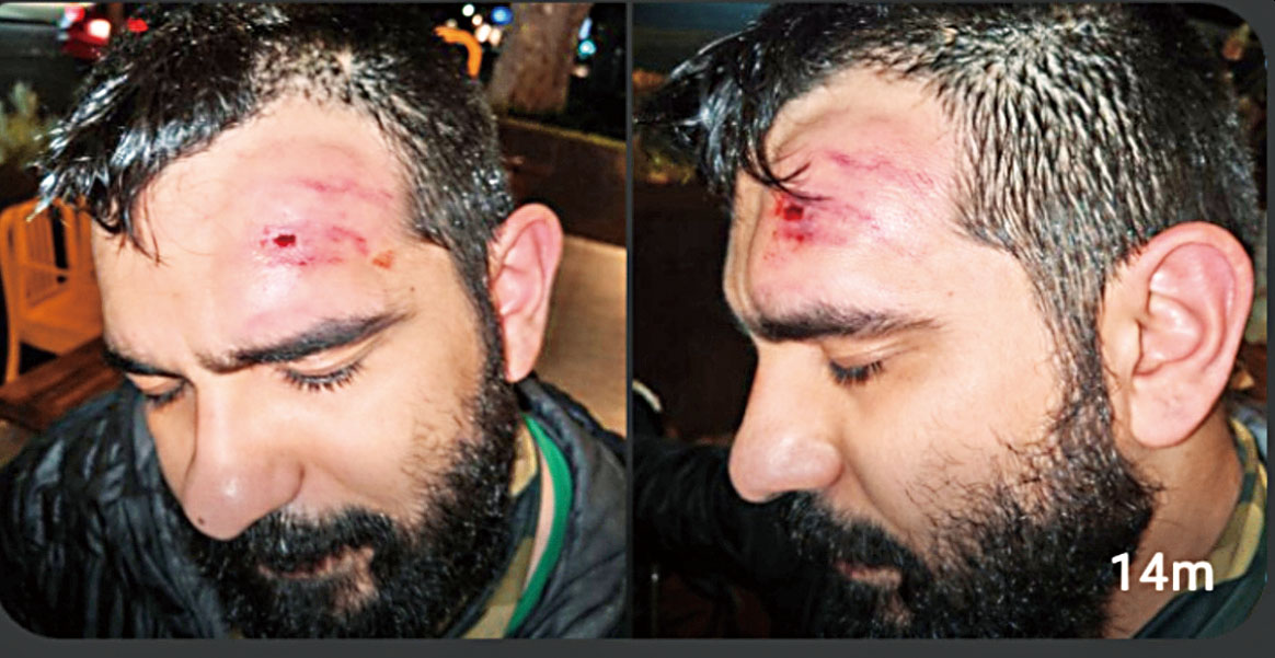 擔任法律觀察員的加爾薩在2020年示威中受傷。全國律師協會沙加緬度分會