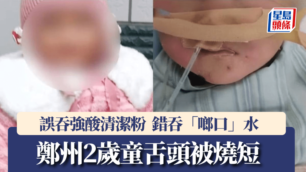 恐怖意外！河南2歲女童誤吞強酸清潔粉 母親灌水急救反令食道灼傷萎縮剩1毫米
