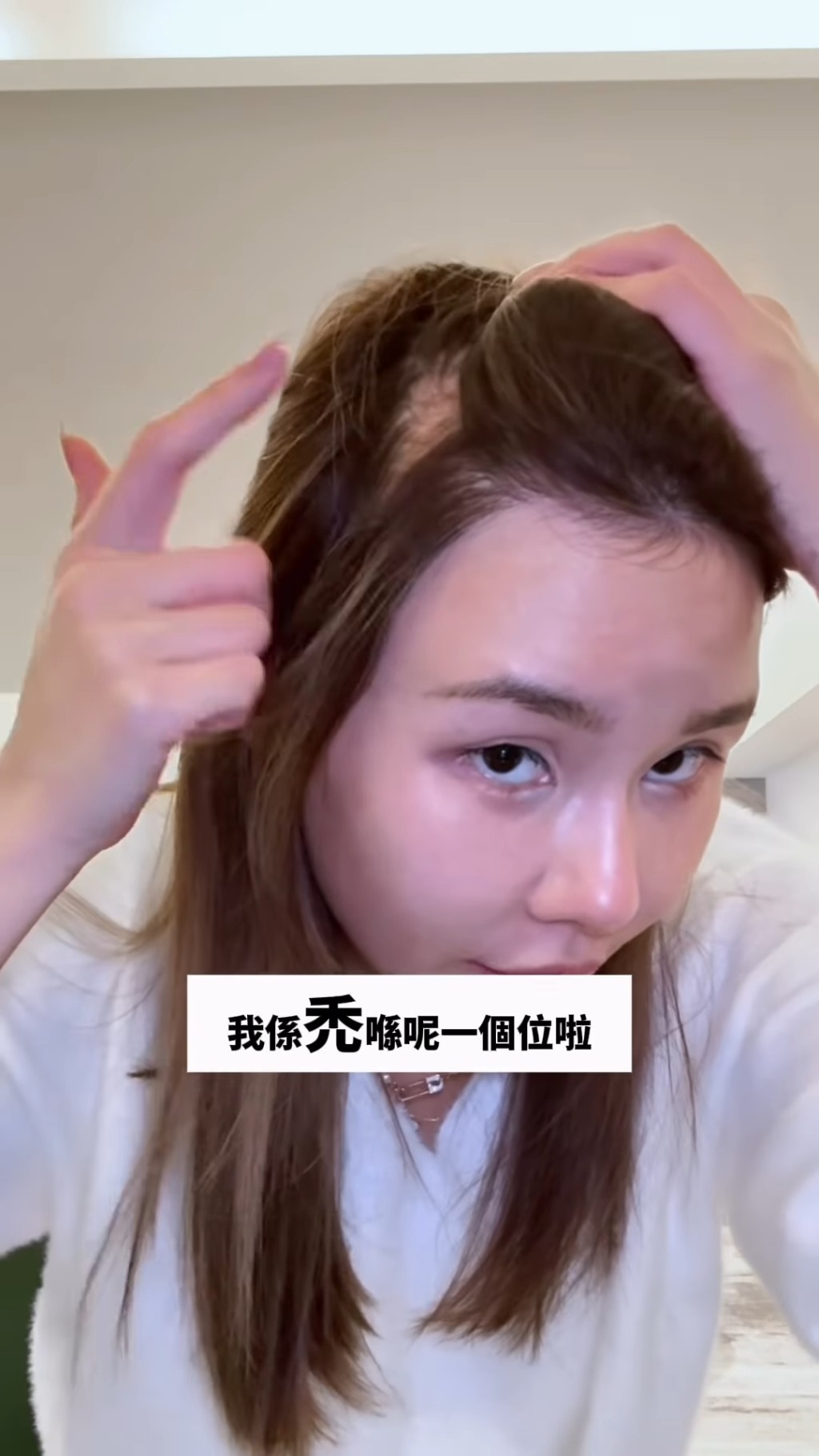 她公開了嚴重脫髮的情況。