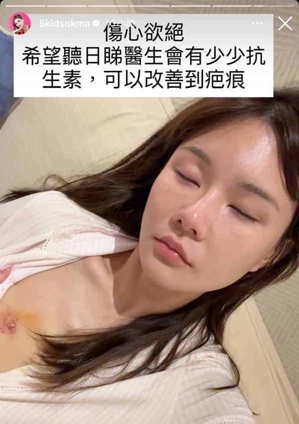她胸部的傷口曝光，寬約兩吋。
